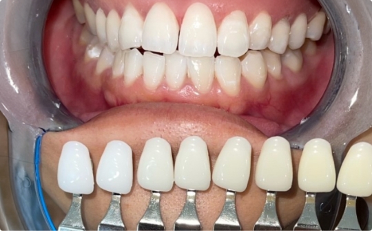 ホワイトニング事業