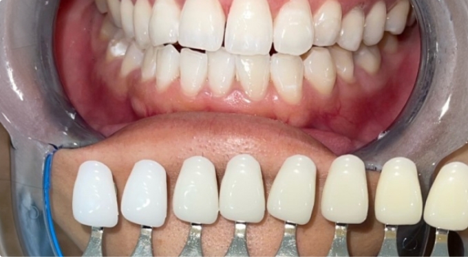 ホワイトニング事業